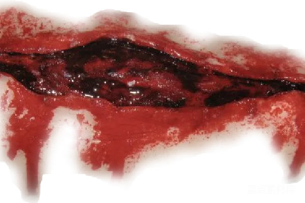 元素素材 scar