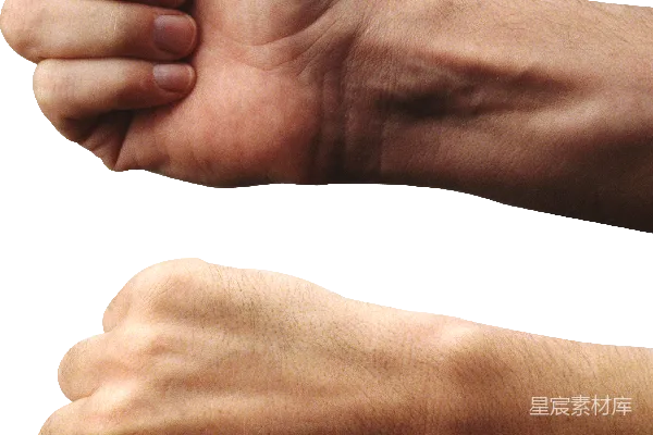 元素素材 thumbs