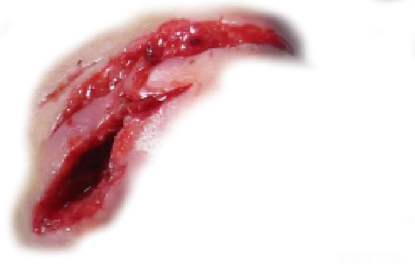 元素素材 Scar