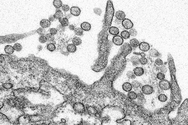 高清摄影 电子显微镜下的病毒从细胞膜脱落图。